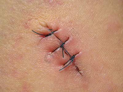 刀疤特效背景_刀疤特效摄影图片_刀疤特效壁纸_摄图网