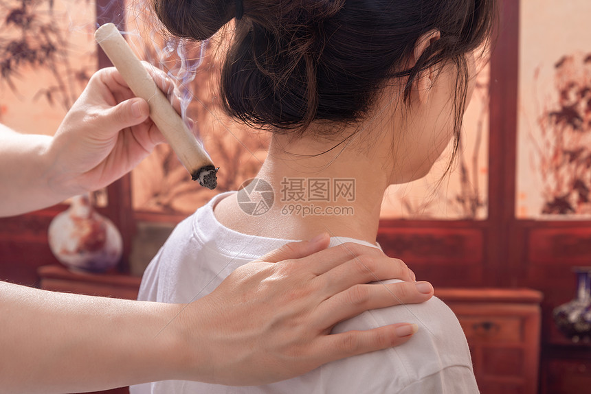 传统中医艾灸疗法高清图片下载-正版图片502503570-摄图网