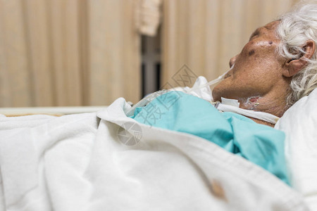 80多岁的亚洲老年女患者在医院重症监护室ICU病房的病床上使用呼吸机进行气管切开术进行背景图片