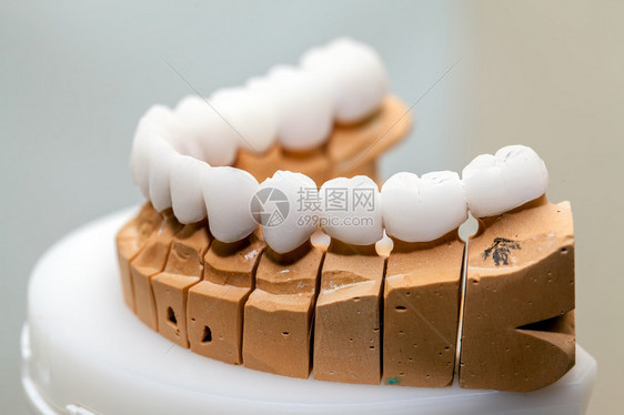 牙医店的锆瓷牙盘图片