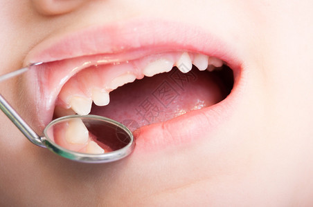牙医使用牙科工具或仪器检查图片