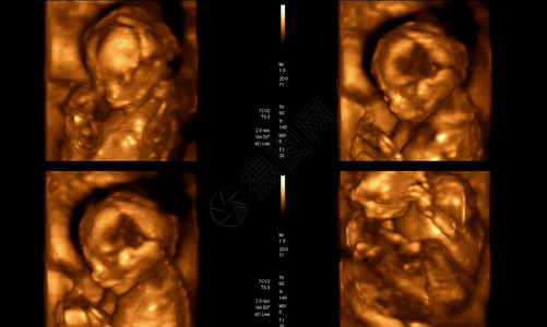 孕妇怀孕期间4D超声波的医学图像拼贴图显示图片