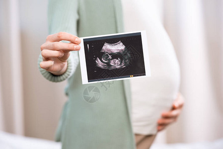 孕妇对婴儿进行超声波检图片