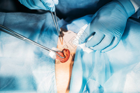 手术室手术室手术腹部病人外科医图片