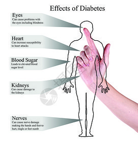 糖尿病的影响图片