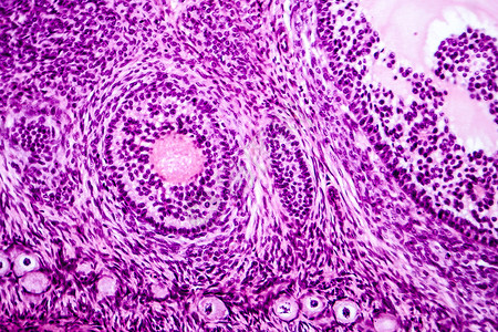 显示原始初级和二级囊泡的卵巢浅显微图图片