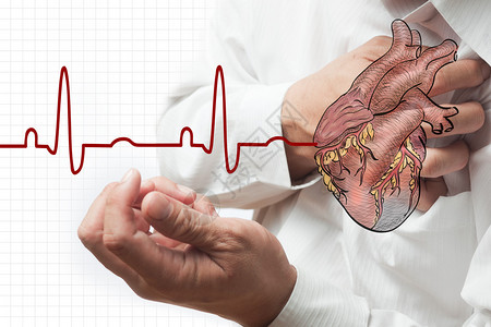 心脏病发作和心跳电图背景图片