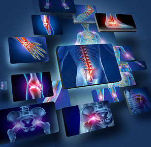 人体关节概念与身体的骨骼解剖学与一组疼痛关节面板发光作为医疗保健和医疗症状的疼痛和伤害或关节图片