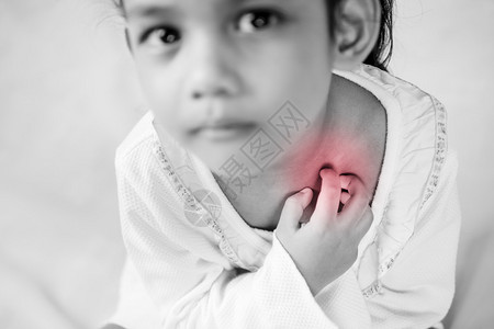 幼女用手抓痒颈部痒保健和医学概图片