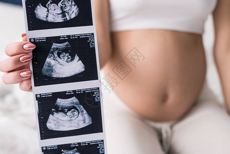 显示超声波扫描的孕妇的裁剪视图图片