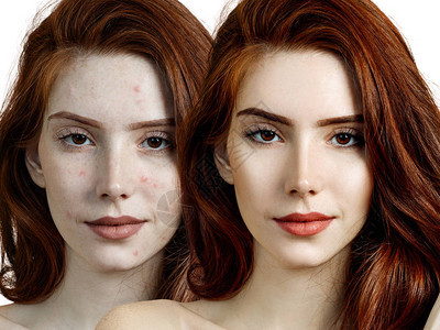 在皮肤治疗和化妆前后年图片