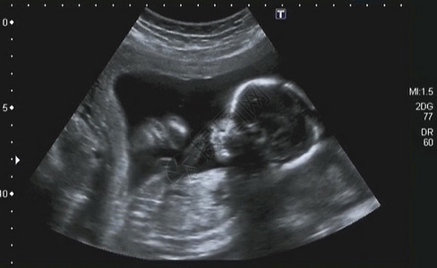 意大利第四月胎儿四月的图片