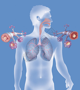 在哮喘病发作期间健康的支气管左和图片