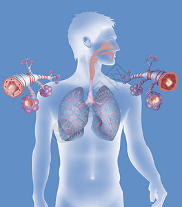 在哮喘病发作期间健康的支气管左和图片