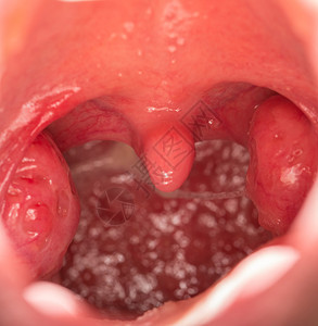 扁桃体张开嘴的特写视图图片