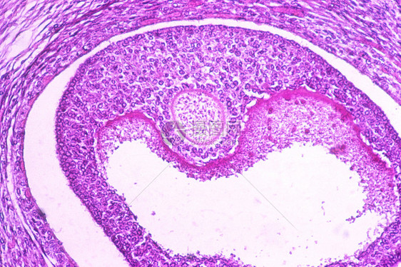 卵巢泡图片