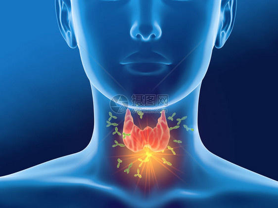 医学3D说明表明抗体攻击妇女图片