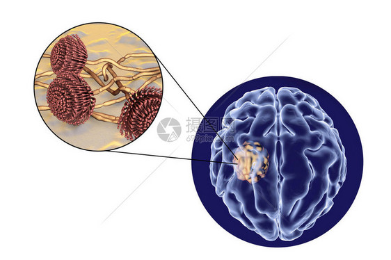 脑曲霉菌和真菌曲霉菌的特写视图图片