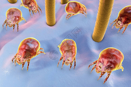 防螨虫用毛发和寄生在灰尘和家具中的寄生虫设计图片