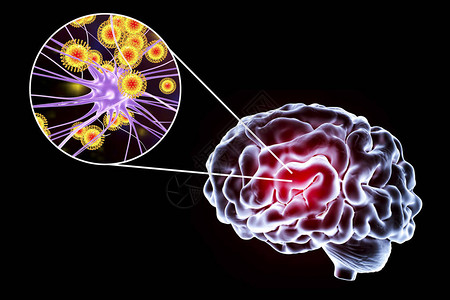 张公山寨3D插图显示大脑和突变神经元设计图片