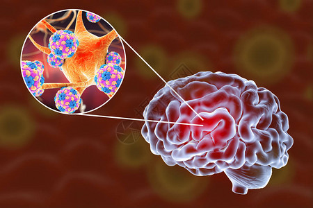 3D插图显示大脑和突变神经元图片