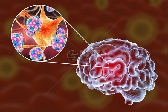 3D插图显示大脑和突变神经元图片