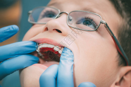 牙科医生检查移动矫形器械图片