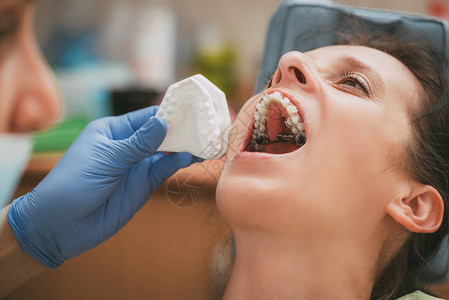 牙医检查女病人的牙套特写真实的人图片