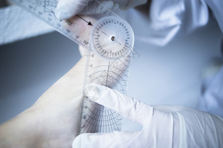 足病学足病学家在医院理疗诊所体检中查用于治疗足部疼痛肌肉损伤拉伤和紧张的手图片