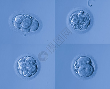 人工受精图片