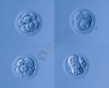 人工受精图片