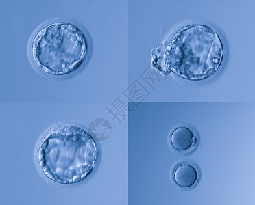 人工受精图片