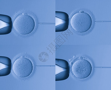 人工受精图片