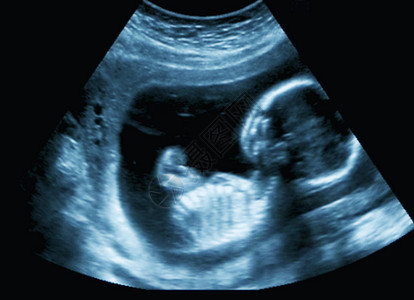 第16周人类胎儿图片