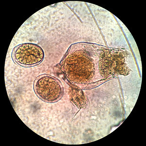 Rotifer光显微镜下图片