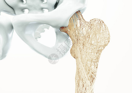 骨质疏松症上肢骨骼人体图片