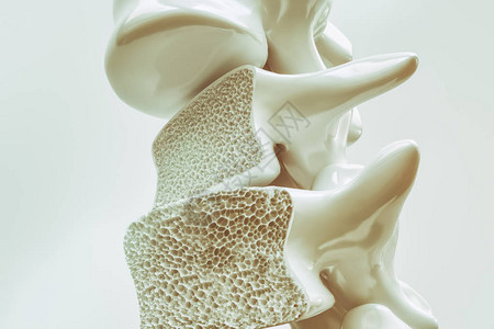 脊柱骨质疏松症3d渲染背景图片