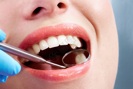 牙医口腔检查时张开嘴的特写图片