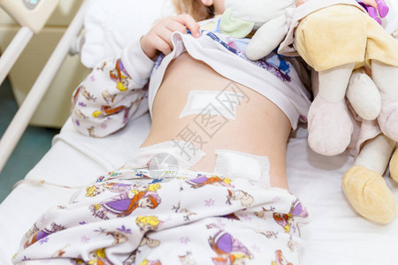 小女孩经外科手术后在腹部和导管上图片