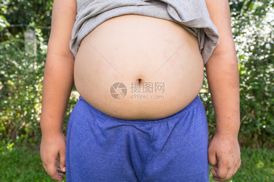 男孩肥胖且不健康有自然背景图片