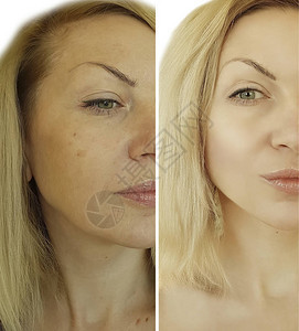 女人脸上皱纹前后图片