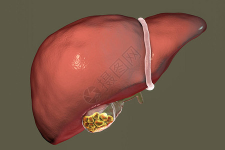 石块3D插图展示肝脏前视和装图片