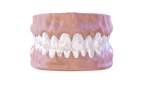 下颌骨人类下巴与牙齿和牙龈解剖模型医学插图隔离在白色背景上设计图片