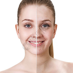 年轻女治疗和化妆前后的对比肖像图片