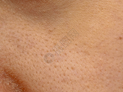 亚洲女干脸上的大毛孔皮肤女鼻子和脸颊皮肤问题毛孔粗大白图片