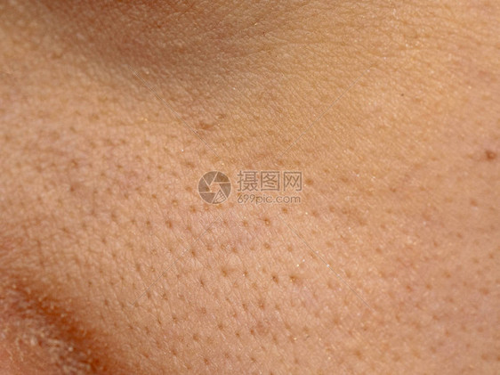 亚洲女干脸上的大毛孔皮肤女鼻子和脸颊皮肤问题毛孔粗大白图片