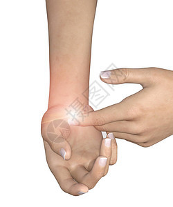 腕管综合征CTS是由于正中神经在腕管处穿过手腕时受压而导致的一种医疗状况主要症状是拇指食指中指疼痛背景图片