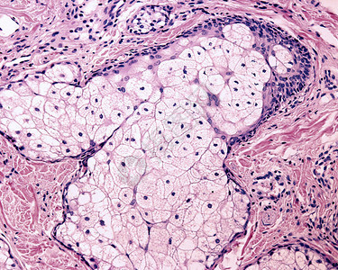 皮脂腺是一种分泌皮脂的全分泌腺细胞以透明液泡的形式积聚油滴最后图片