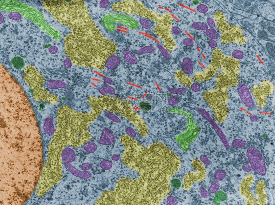 神经元细胞体的假彩色透射电子显微镜TEM显微照片显示线粒体图片
