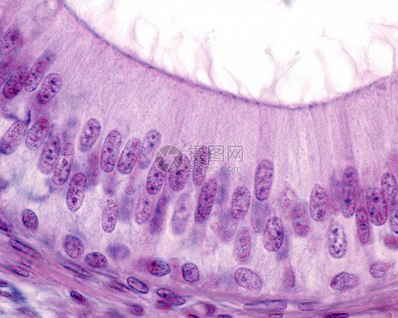 皮尔多斯特Pseudostanized的单列缩充膜上皮细胞显示在相片表图片